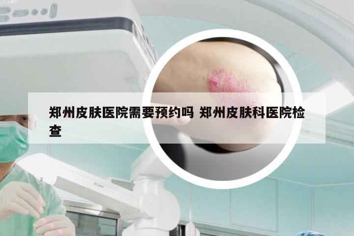 郑州皮肤医院需要预约吗 郑州皮肤科医院检查