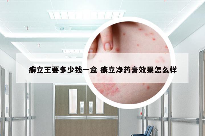 癣立王要多少钱一盒 癣立净药膏效果怎么样