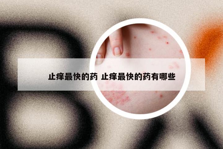 止痒最快的药 止痒最快的药有哪些