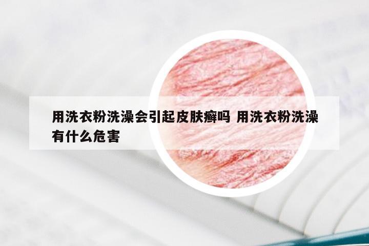 用洗衣粉洗澡会引起皮肤癣吗 用洗衣粉洗澡有什么危害