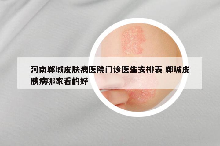 河南郸城皮肤病医院门诊医生安排表 郸城皮肤病哪家看的好