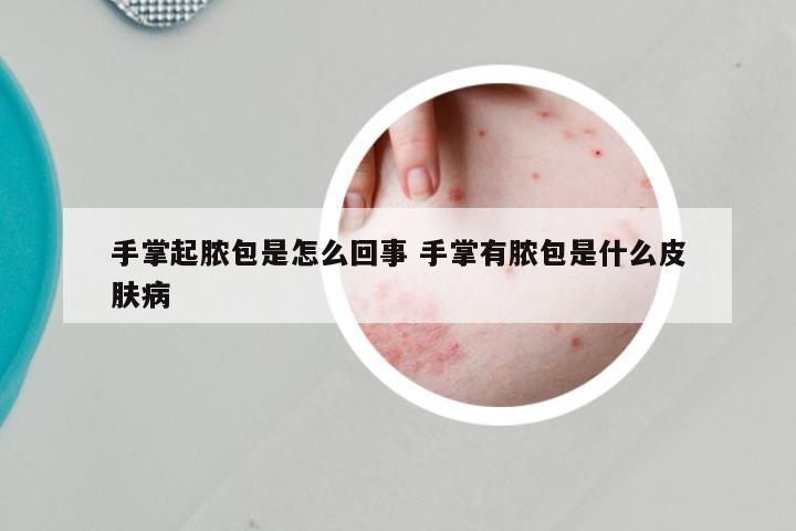 手掌起脓包是怎么回事 手掌有脓包是什么皮肤病