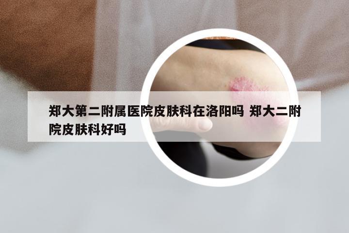 郑大第二附属医院皮肤科在洛阳吗 郑大二附院皮肤科好吗