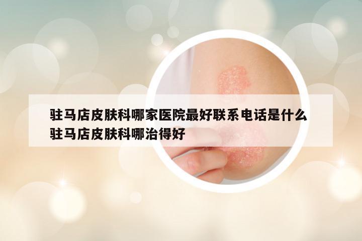 驻马店皮肤科哪家医院最好联系电话是什么 驻马店皮肤科哪治得好