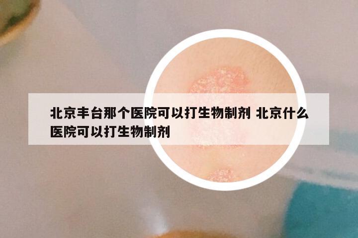 北京丰台那个医院可以打生物制剂 北京什么医院可以打生物制剂