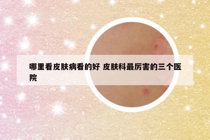 哪里看皮肤病看的好 皮肤科最厉害的三个医院