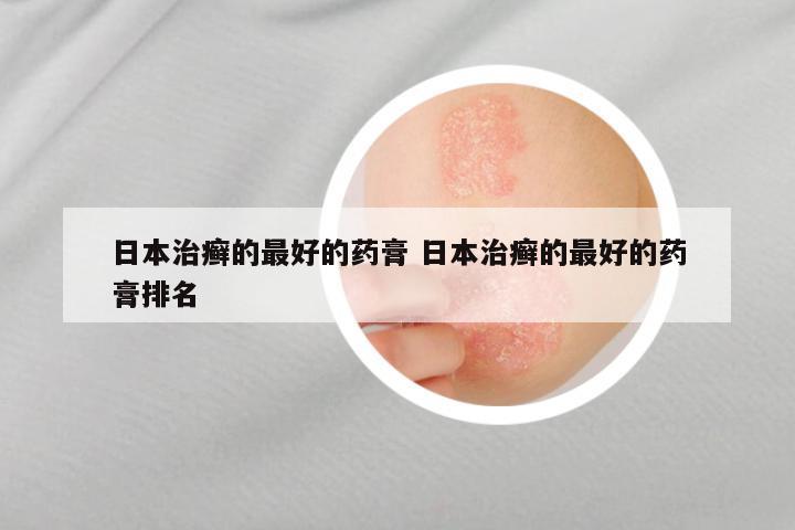日本治癣的最好的药膏 日本治癣的最好的药膏排名