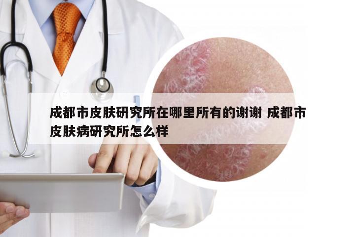 成都市皮肤研究所在哪里所有的谢谢 成都市皮肤病研究所怎么样