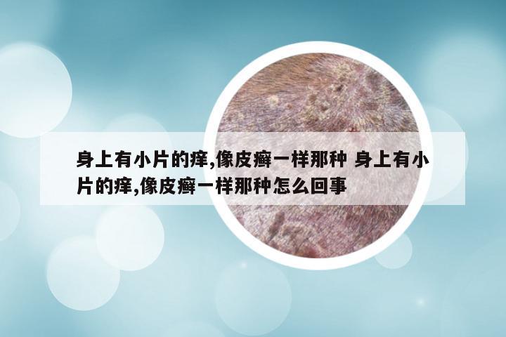 身上有小片的痒,像皮癣一样那种 身上有小片的痒,像皮癣一样那种怎么回事