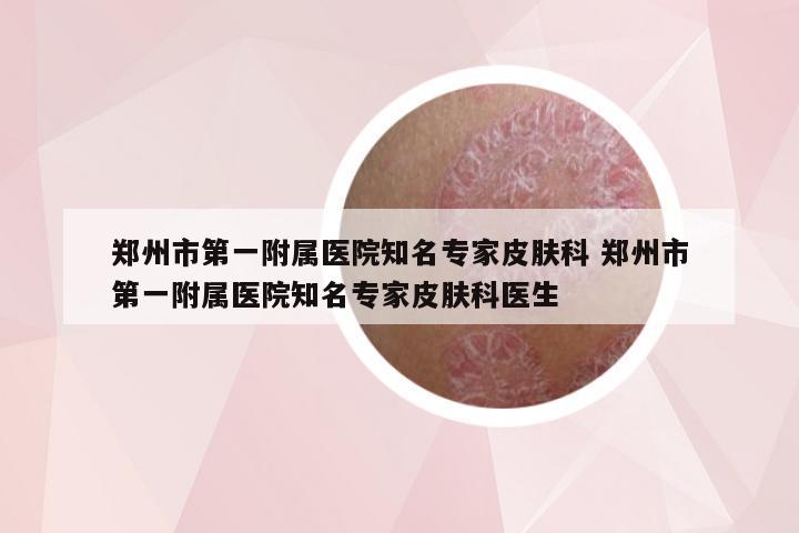 郑州市第一附属医院知名专家皮肤科 郑州市第一附属医院知名专家皮肤科医生