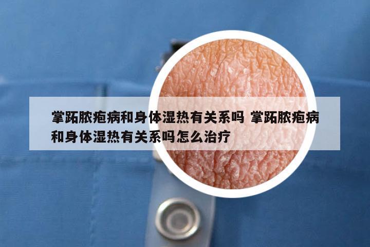 掌跖脓疱病和身体湿热有关系吗 掌跖脓疱病和身体湿热有关系吗怎么治疗