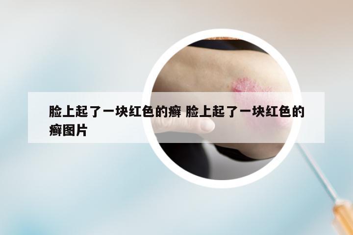 脸上起了一块红色的癣 脸上起了一块红色的癣图片