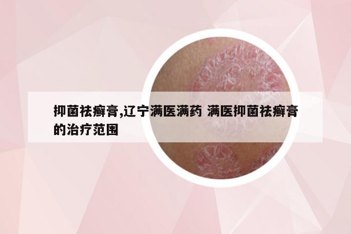 抑菌祛癣膏,辽宁满医满药 满医抑菌祛癣膏的治疗范围