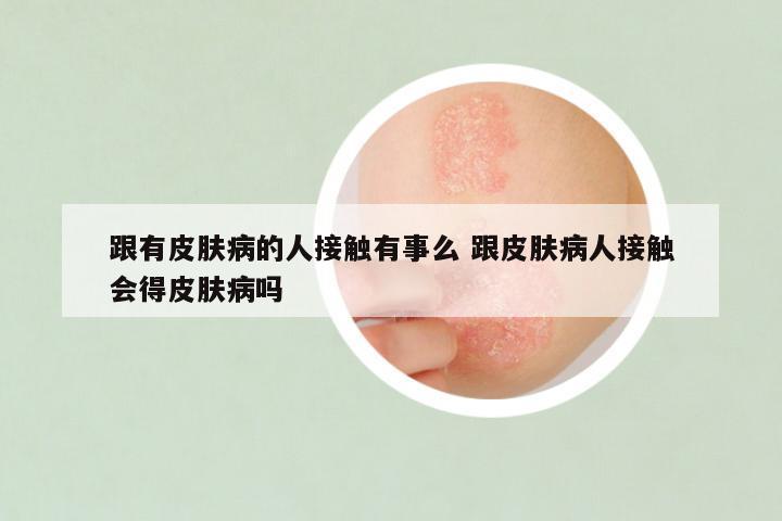 跟有皮肤病的人接触有事么 跟皮肤病人接触会得皮肤病吗