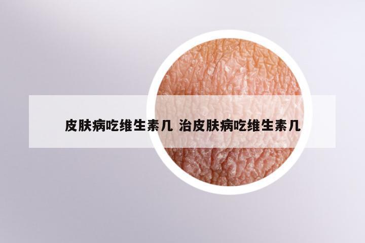 皮肤病吃维生素几 治皮肤病吃维生素几