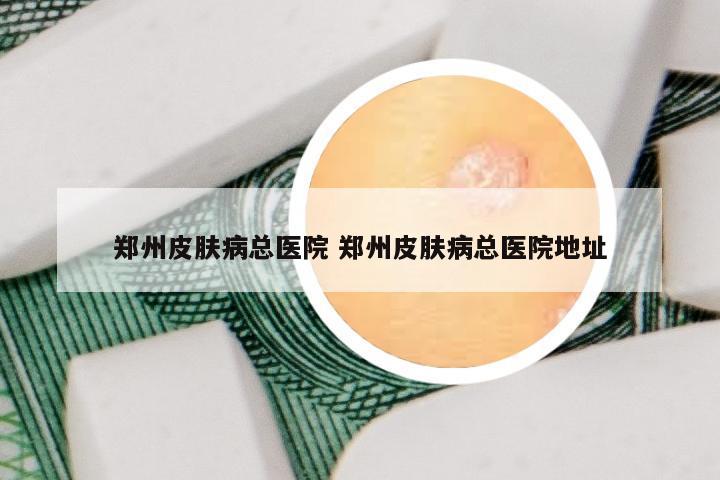 郑州皮肤病总医院 郑州皮肤病总医院地址