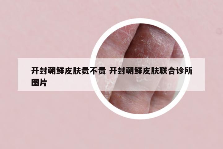 开封朝鲜皮肤贵不贵 开封朝鲜皮肤联合诊所图片