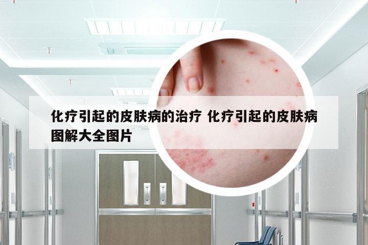 化疗引起的皮肤病的治疗 化疗引起的皮肤病图解大全图片