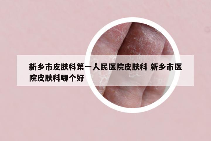 新乡市皮肤科第一人民医院皮肤科 新乡市医院皮肤科哪个好