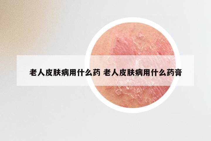 老人皮肤病用什么药 老人皮肤病用什么药膏