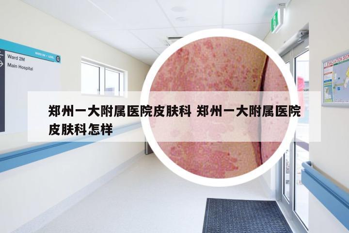 郑州一大附属医院皮肤科 郑州一大附属医院皮肤科怎样