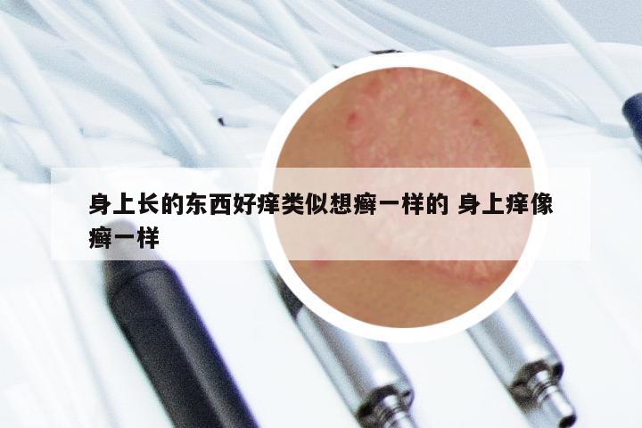 身上长的东西好痒类似想癣一样的 身上痒像癣一样