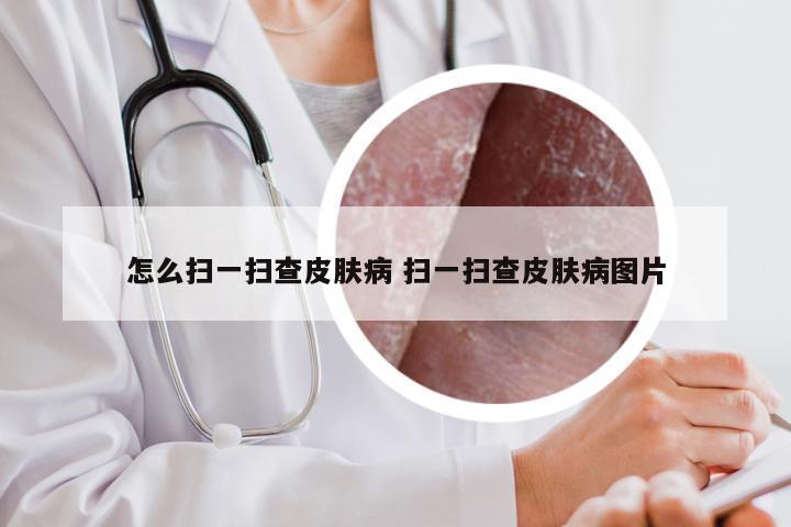 怎么扫一扫查皮肤病 扫一扫查皮肤病图片