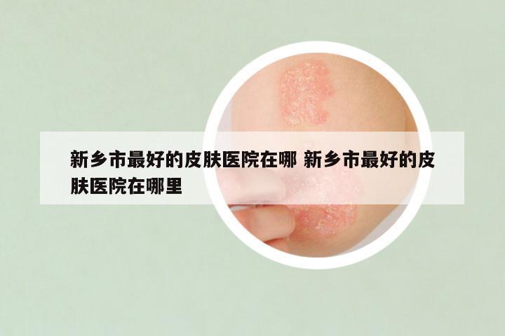 新乡市最好的皮肤医院在哪 新乡市最好的皮肤医院在哪里