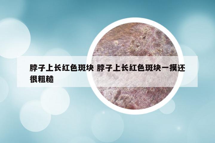 脖子上长红色斑块 脖子上长红色斑块一摸还很粗糙