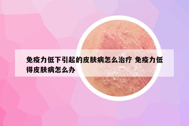 免疫力低下引起的皮肤病怎么治疗 免疫力低得皮肤病怎么办