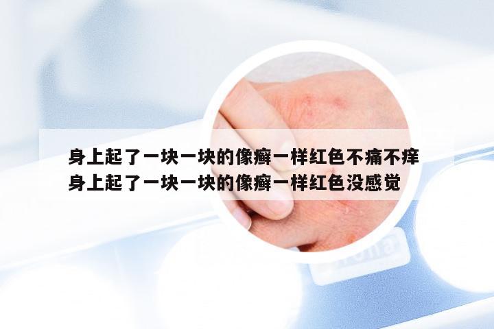 身上起了一块一块的像癣一样红色不痛不痒 身上起了一块一块的像癣一样红色没感觉