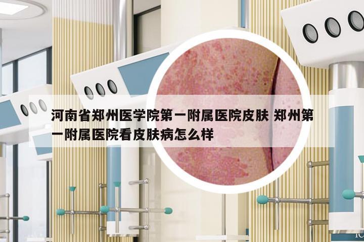 河南省郑州医学院第一附属医院皮肤 郑州第一附属医院看皮肤病怎么样