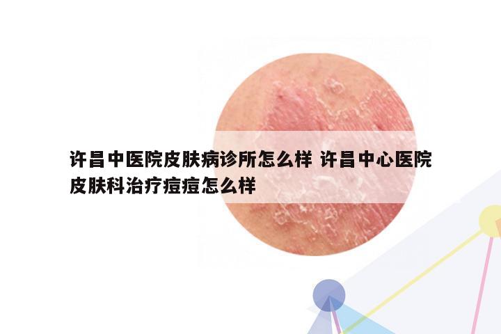 许昌中医院皮肤病诊所怎么样 许昌中心医院皮肤科治疗痘痘怎么样
