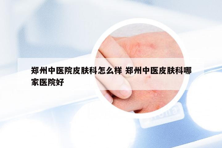 郑州中医院皮肤科怎么样 郑州中医皮肤科哪家医院好