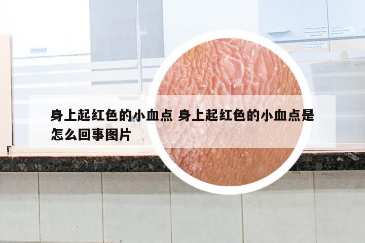 身上起红色的小血点 身上起红色的小血点是怎么回事图片