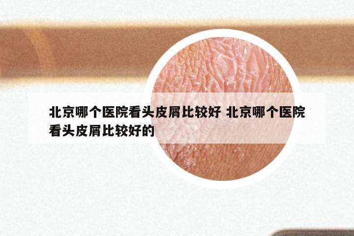 北京哪个医院看头皮屑比较好 北京哪个医院看头皮屑比较好的