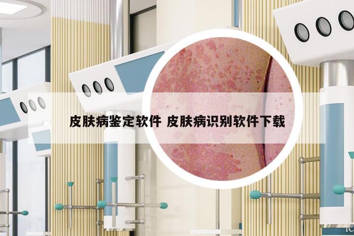 皮肤病鉴定软件 皮肤病识别软件下载