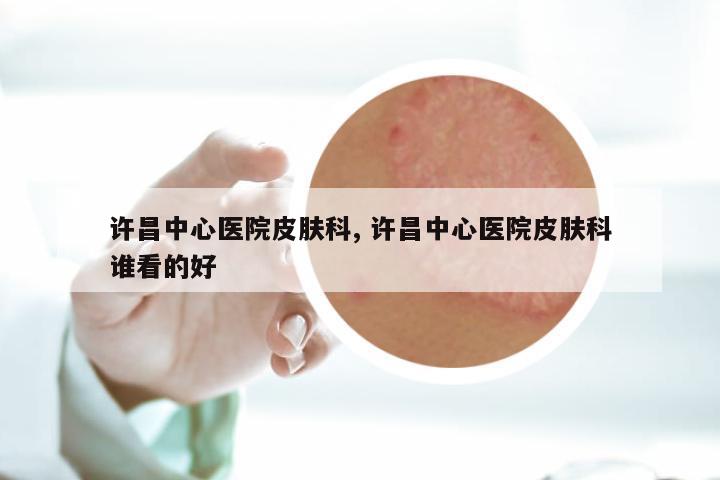 许昌中心医院皮肤科, 许昌中心医院皮肤科谁看的好
