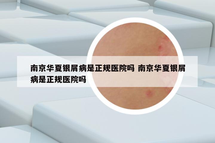 南京华夏银屑病是正规医院吗 南京华夏银屑病是正规医院吗