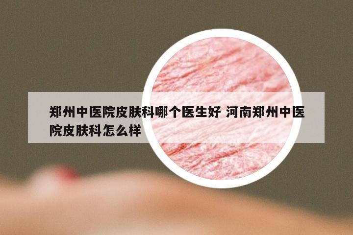郑州中医院皮肤科哪个医生好 河南郑州中医院皮肤科怎么样