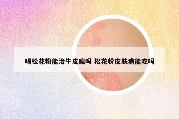 喝松花粉能治牛皮廨吗 松花粉皮肤病能吃吗