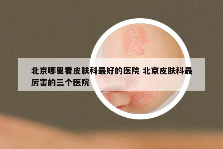 北京哪里看皮肤科最好的医院 北京皮肤科最厉害的三个医院