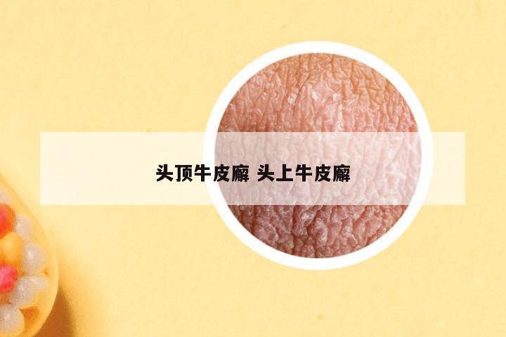 头顶牛皮廨 头上牛皮廨