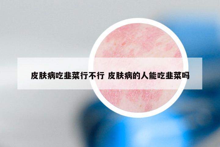 皮肤病吃韭菜行不行 皮肤病的人能吃韭菜吗