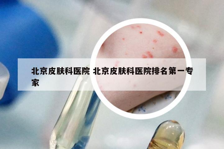 北京皮肤科医院 北京皮肤科医院排名第一专家