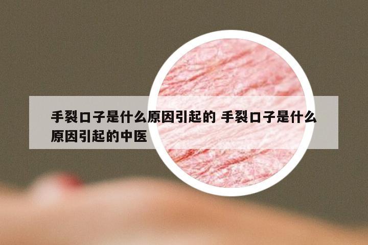 手裂口子是什么原因引起的 手裂口子是什么原因引起的中医