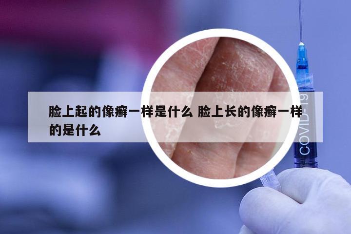 脸上起的像癣一样是什么 脸上长的像癣一样的是什么