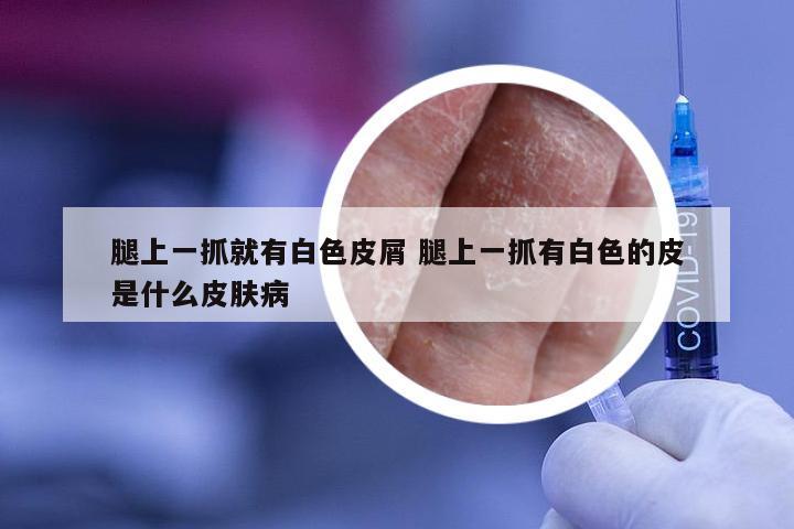 腿上一抓就有白色皮屑 腿上一抓有白色的皮是什么皮肤病