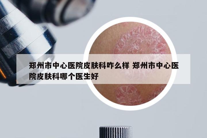 郑州市中心医院皮肤科咋么样 郑州市中心医院皮肤科哪个医生好