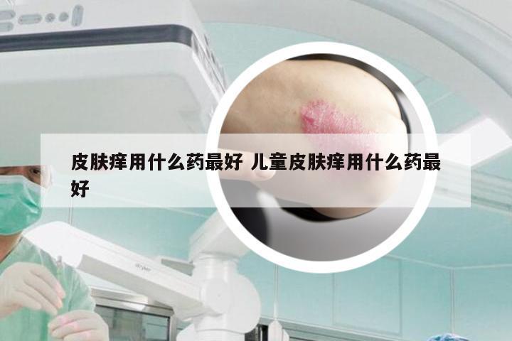 皮肤痒用什么药最好 儿童皮肤痒用什么药最好